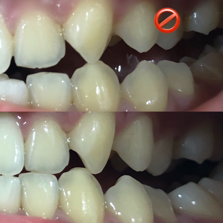 전/후 차이입니다
큰 차이는 없죠? 오래 사용한 사진이 아니라, 시각적인 후기 보다는 제 생생한 느낌을 전해드리고 싶었는데 여러분께 잘 전해졌을 지 모르겠네요!