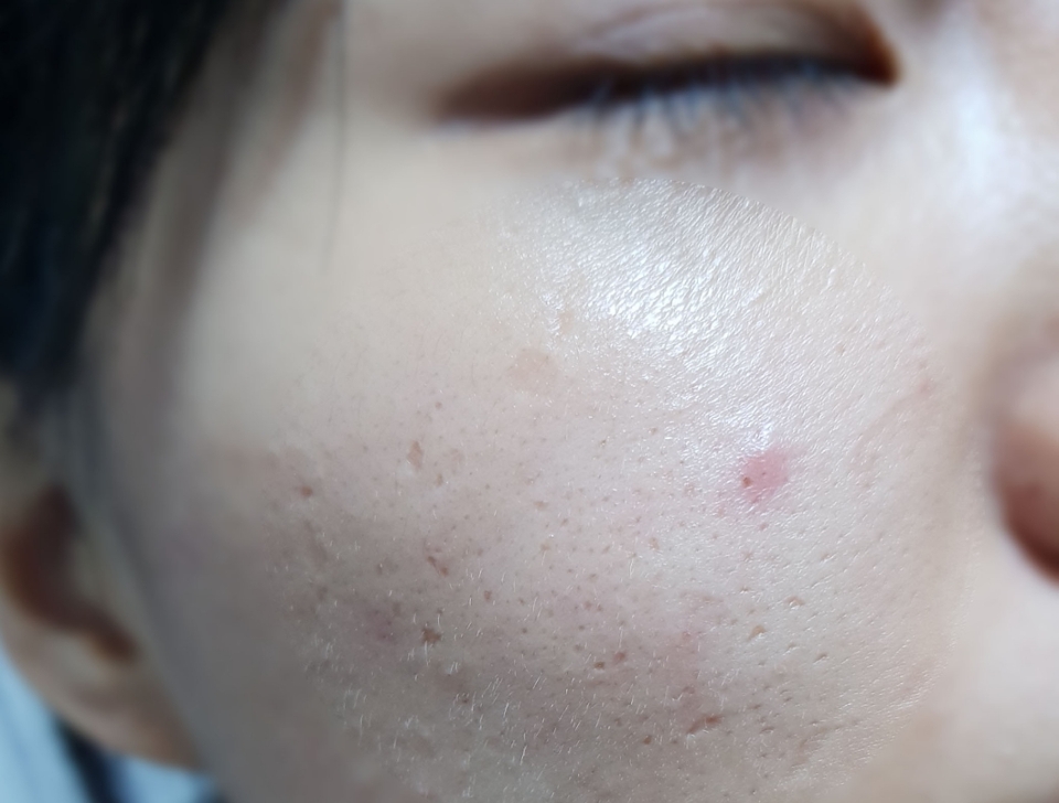 사용전이에요.
저녁이되어올라온유분과피지를말끔하게 제거해볼게요