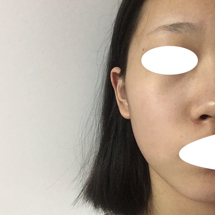 세안 직후의 생얼이에요 되게 건조한 상태에요 피부 나오는 사진들은 전부 무보정이에여