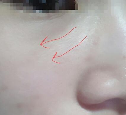...ㅎ...ㅋㅋㅋㅋㅋㅋㅋㅋㅋㅋ 아 숨고싶네요 엄청난 피부당김 찔찔