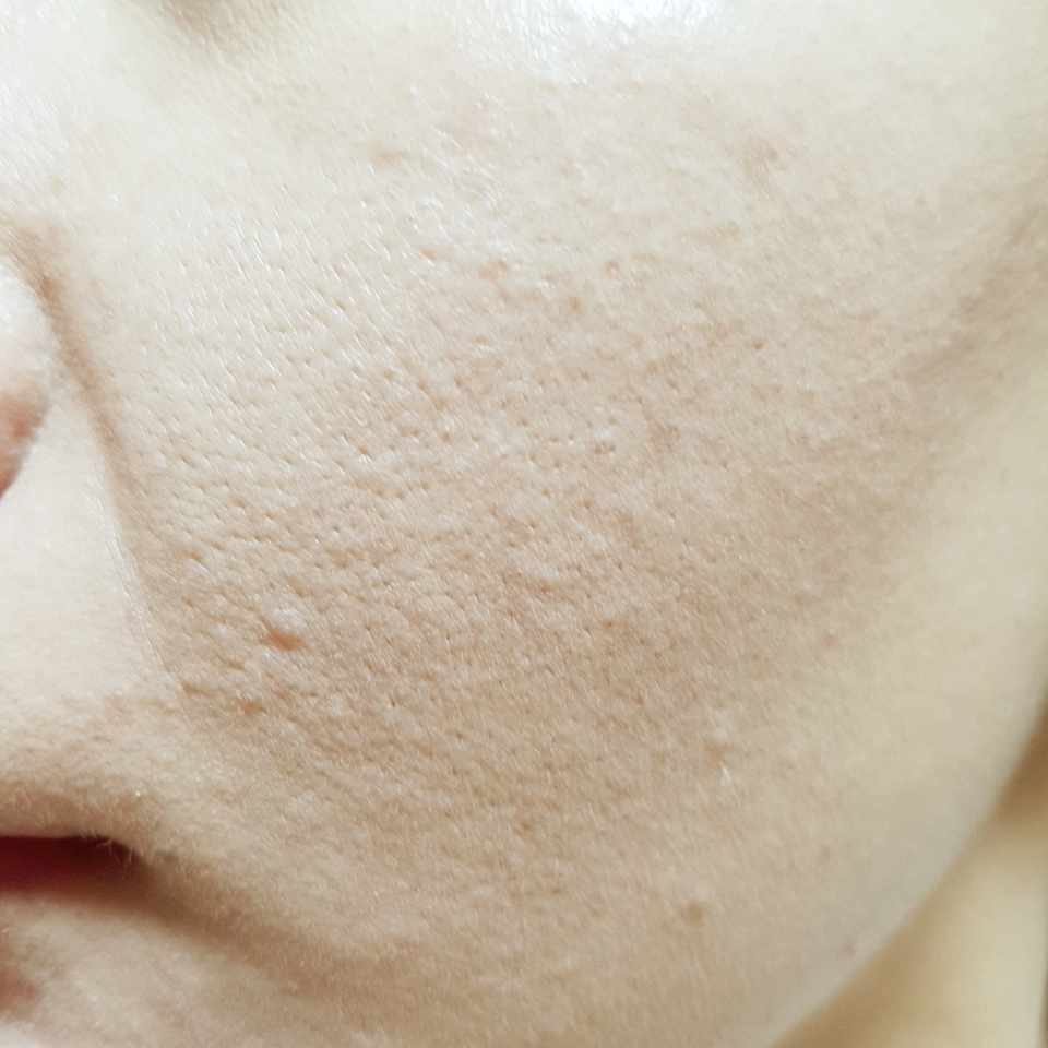 바른 직후 사진!
눈부신 결광커버라고 했는데
전 그 결광을 느끼지 못했어요.
커버글로우쿠션인데 
글로우함을 잘 모르겠는...
자개 파우더 때문인지 
글로우함이 죽는 것 같았어요.
그리고 쿨링감이 다른 쿨링쿠션에 비해서
확실히 느낄 수 있었어서 그 점은
참 좋았던 것 같아요. ^^
스킨푸드의 보틀쿠션 정도까진 아니지만
가스에 의함이 아닌 시원함이었기 때문에
쿨링감은 합격!ㅋㅋㅋㅋㅋ