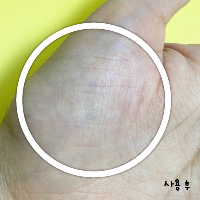 얼굴에 사용하기 전에
손바닥의 주름진 부위에 사용해 봤는데요,

잔주름이 어느 정도 메워진 모습입니다.