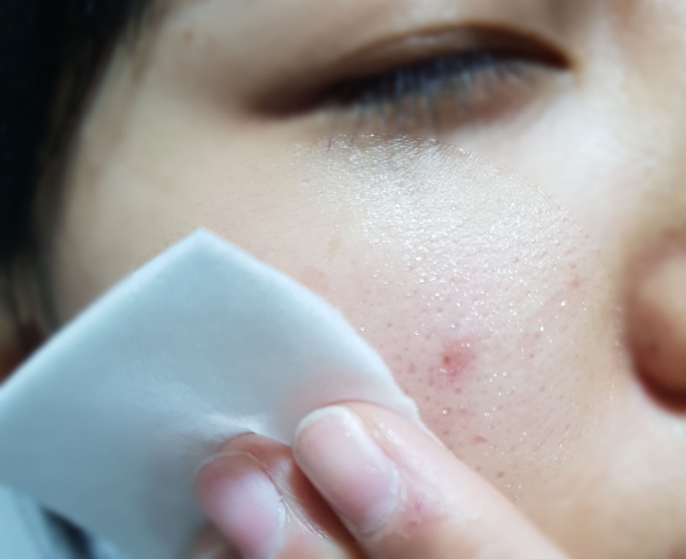 닦아내는토너로쓰면좋은 초민강피부를위한토너답게 피부에 흡수가좋고. 자극이없네요