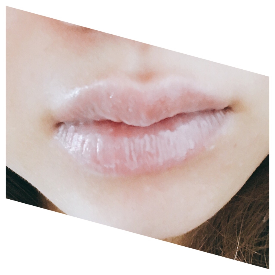 짠- 
다음날 아침에 이렇게 각질이 불어서 올라온 것이 보이시죠?
입술 각질 없애는법 10초만 투자했는데!!