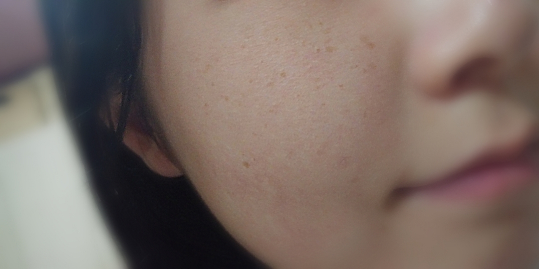 맨 얼굴입니당 요즘 변해가는 날씨때문에 건조하고 난리인 얼굴이에요