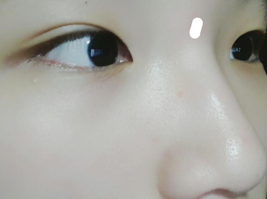 3일정도하면 이렇게 변합니다...짱bb스고이 자기전에 20초만 투자하세요.. 하루에 한두번정도 추천합니당