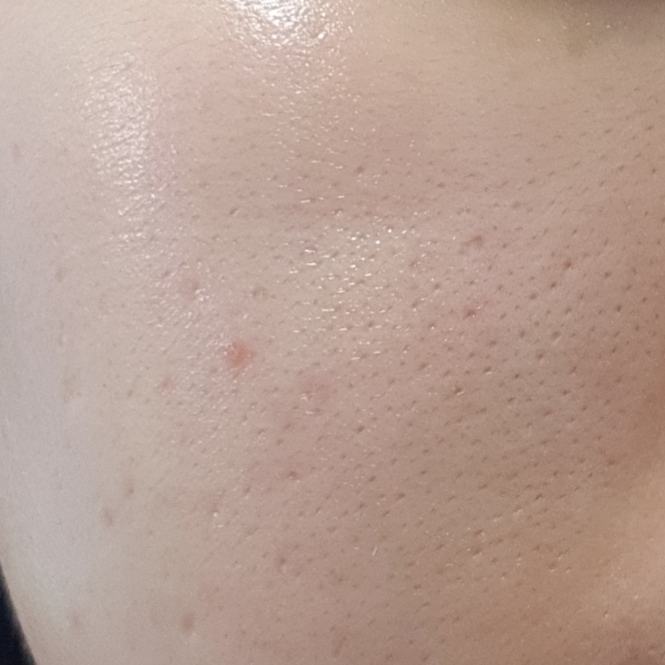 마무리감에 유분기나 수분기 전혀 없고 빠르게 흡수가 되는데 때문에 밤에 말고 화장 전에 바르시는걸 추천드려요!

향은 전형적인 로션 향입니다

3일정도 사용해본 결과 자극이 없어서 예민한 피부를 가지신 분들께 추천드리고 봄에바르실 세럼으로 추천드려요!