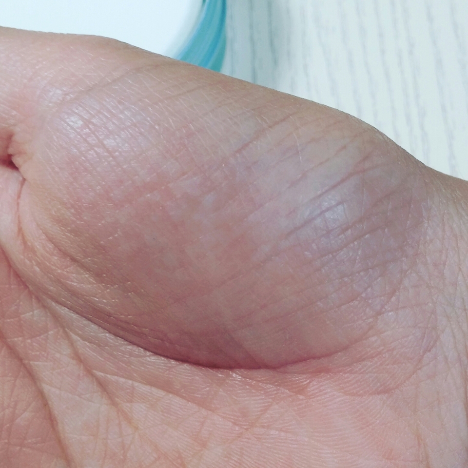 바른 후입니당!약간 차이가 보이시나요??이제품은 모공 커버를 완벽히 기대하시는분들에겐 비추천하구요 기름이 올라오는걸 막아주는 부분에선 탁월해요!!보송한 피부표현이 되서 여름에 잘쓸거같아요♥ 모공커버는 100%에서 40%정도 되는거같아요!