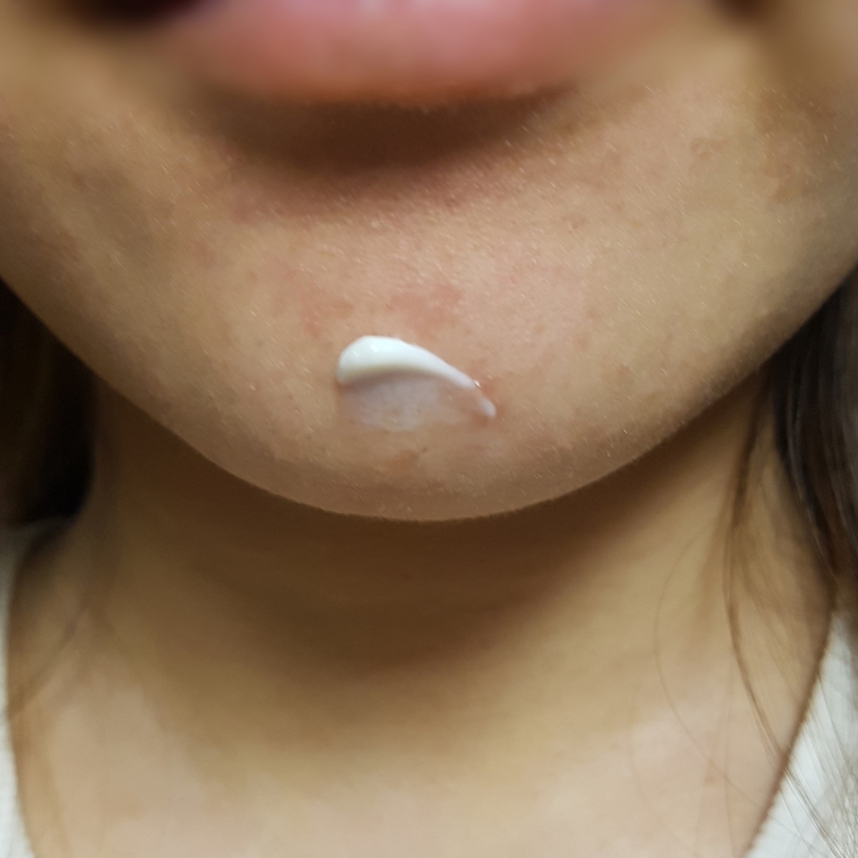 이번엔 턱 ....... !
제피부는 볼이랑 턱이 제일 건조한편인데 이 크림을 발라주니까
전에는 크림을 발라도 건조함을 계속 느꼈었는데 바르고난후에는 건조함이 없고 피부가 정말 쫀쫀해져요 !💕