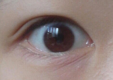 생눈.... ㅠ