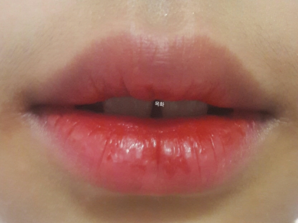 현제 저의 입술...
착색으로 붉어요 
하...하핳
