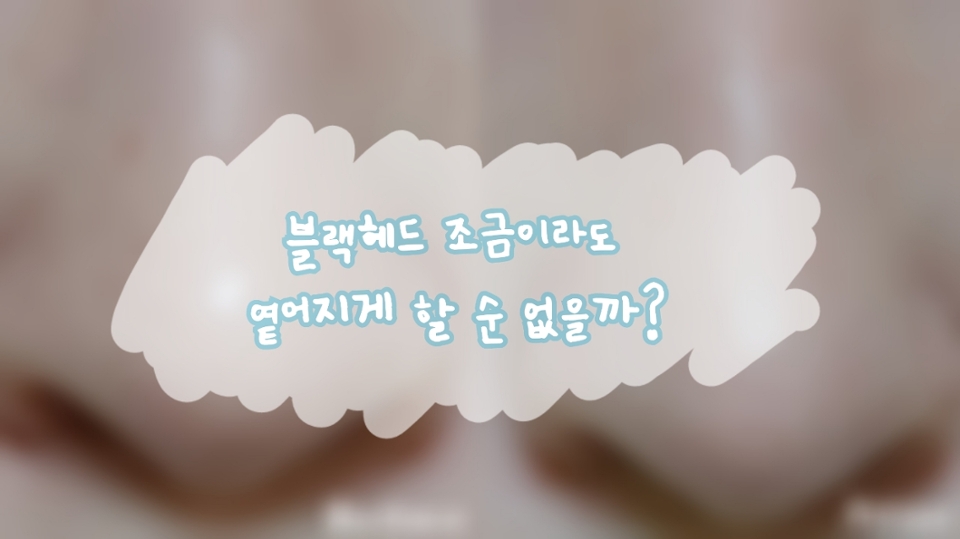 블랙헤드.. 언젠간 없앨 수 있겠죠!! 