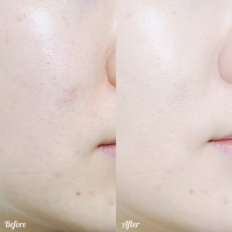 매트 쿠션은 각질 부각이 심해서 피부 상태가 안좋을 땐 엄두도 못내는데, 비벨벳 쿠션은 각질 부위에 결이 약간 달라보인다-정도고 크게 들뜨거나 피부결이 거칠어보이지 않아 만족!

​

피부 상태가 좋을 때 쓰면 정말 실키한 피부 표현을 할 수 있지 않을까 싶어요

​

요약하자면 민감해진 피부에도 사용감은 편안했고, 커버력은 극상, 각질 부각이나 들뜸 없이 퍼포먼스도 중상 이상이었다