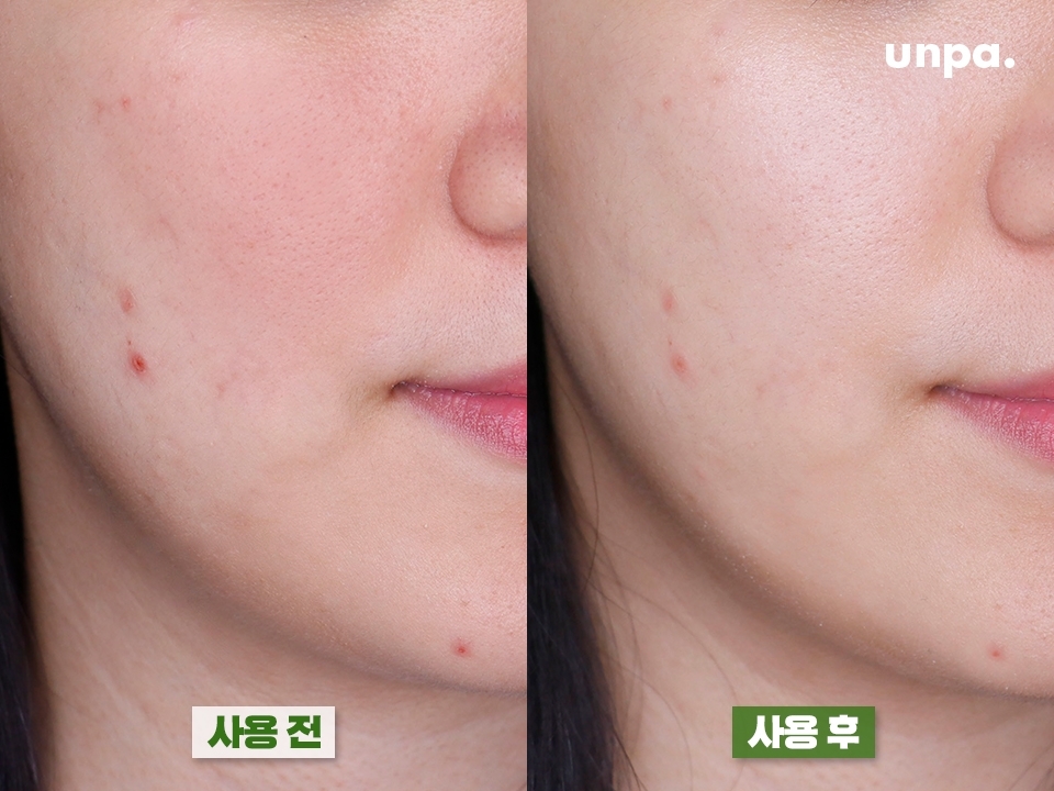 뜨거운 자외선, 습한 날씨, 에어컨, 선풍기 바람으로 
민감 폭발인 내 피부를 바로 진정시켜주는 수딩 트리트먼트!
더마 맥스 포뮬라™가 농축되어 있어 가능한 진정 효과라구~
바캉스 내내 수딩 트리트먼트 달고 다닌 건 안 비밀 ㅇ,<
