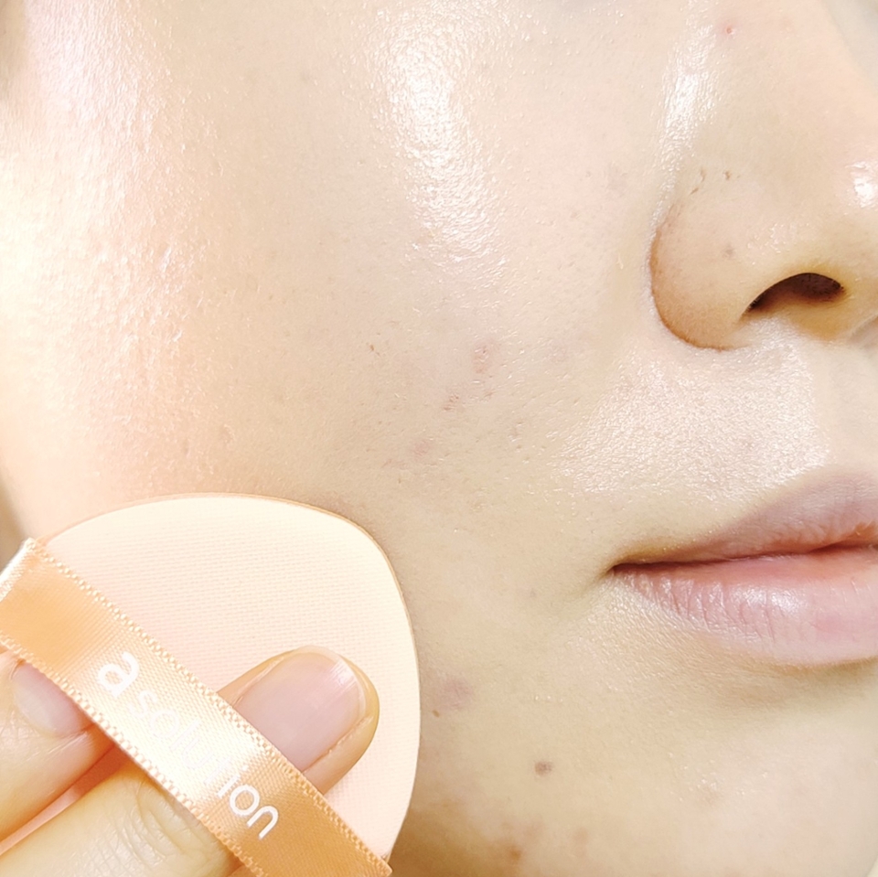 피부에 올라가는 느낌은 챱챱하니 에센스의 수분감이 느껴지는데, 막상 픽싱되고 나면 질척이는 타입은 또 아니라 신기!

​

촉촉하면서 딱 예쁠 정도로 자연스럽게 피부 광채를 살려주는 타입이에요

​

트러블이 올라왔을 땐 화장품 속 자극성 성분부터 모공 막힘 까지 피부 상태가 더 나빠지는건 아닐까 화장할 때 부담되는 부분이 많은데, 에이솔루션 아크네커버팩트는 논코메도제닉 테스트와 피부 자극 테스트까지 완료했다고 해서 그나마 걱정이 덜하더라구요

​

20가지 유해 성분도 당연히 free!

