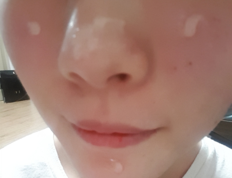 코랑 코옆 볼 쪽 부분으로 콕콕 찍어줬어요 ㅎㅎ
아직까지는 젤제형이지만!?