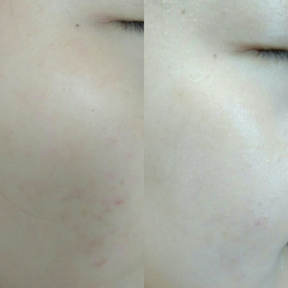 전과 후 사진이예요.
확실한 비교를 위해  사진 보정을 하지 않았는데
자연스럽게 톤을 밝혀줘요!

'매일 화장하긴 부담스럽고
화장하긴 싫은데 차마 민낯으로는 나갈수 없다'

할때 요긴하게 쓰여요 ㅎㅎ
여름이니까 선크림 발라야 하는데
크림보단 가볍죠😃