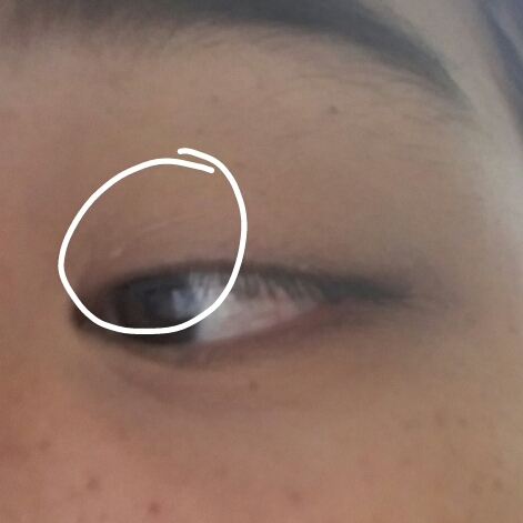 쌍커풀라인 잘 못잡으시는분들이있는데 눈 저렇게 뜨면 흰색동그라미친부분처럼 저렇게 라인이보여요 저대로 그으시면되요
