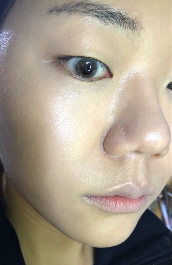 올려주었어요.

모두들 이미 알고계시겠지만 블랙쿠션은 매트한 질감의 쿠션제품입니다. 하지만 저는 기초를 튼튼히 하는 편이라 은은하게 속광이 비치면서 겉은 살짝 매트한 게 진짜 피부가 예뻐보이고 좋더라구요. 
제 피부 보시면 아시겠지만 헤라 블랙쿠션은 붉은기 커버 진짜 잘되고요, 조금 두껍게 올려주면 요철커버도 잘 되요. 올리면 올리는대로 그냥 알아서 잘 커버해주는 똑똑한 쿠션제품이라고 감히 말씀드립니다. 진짜진짜 좋아요!! 진짜 좋다고!!!!

사실 처음 한 통 쓸때는 좋은 거 잘 모르고 썼는데 두번 째 통 다 털어쓸때 쯤 응? 이거 진짜 좋은데?? 싶었고
지금 세번째 통 쓰면서 아 이거 진짜 좋구나를 느꼈다고 한다.

제 느낌상 
커버력  : 상
지속력 :  상
무너짐 : 거의없음

이 정도? 진짜 아침에 귀찮을 때 이걸로 파바바박 베이스 해주면 피부가 찰떡처럼 먹는 느낌?

그리고 수정용으로도 솔직히 괜찮아요. 진짜로. 
