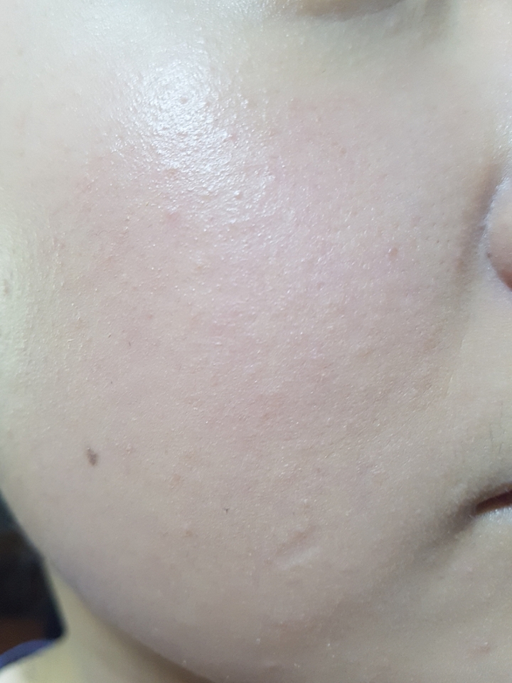 1번 펴발라본 상태입니다