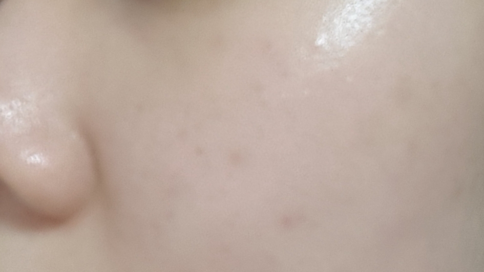 바르고 난 후인데 유분감이랑 코팅 된 그런 느낌이 전달 되나요 !?!??!? 
확실히 보습감을 더 느낄 수 있었고 진정, 안정 되는 느낌이 확실히 있답니다 ㅠㅠ 

이거때문인지는 모르겠는데 붉은끼도 최근들어 많이 가라앉았어요 꾸준하게 사용해준 효과인건강 ㅇㅅㅇ 😘

이렇게 오늘 리뷰를 마치도록 하겠습니다 ! 긴글 읽으시고 보시느라 수고 많으셨어요 나중에 또 봬요 👋👋