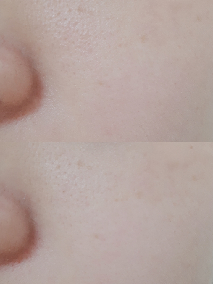 사용하기 전에는 피부가 건조하고 각질도 올라오고 
코 주변에 유분이 많이 있었는데

사용 후에 피부도 촉촉하고 유분도 잡아주고 
굉장히 산뜻해서 좋았어요!

항상 처음에 스킨 제품 사용하면 얼굴이 가렵고 울긋불긋 거렸는데
이 제품은 그런 현상도 없어서 되게 좋았던 것 같아요!

항상 피부에 안 맞아서 다 쓸때마다 토너를 바꿨는데
이제 이 토너로 계속 사용할 것 같아요 ~💜