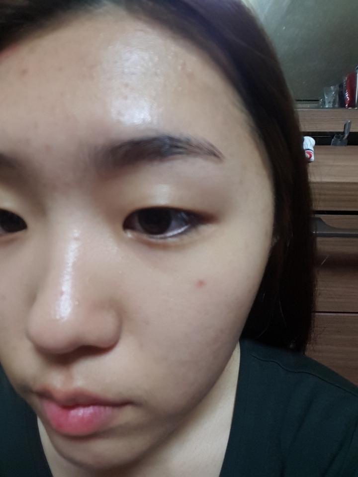 로션 바르구 나서~~