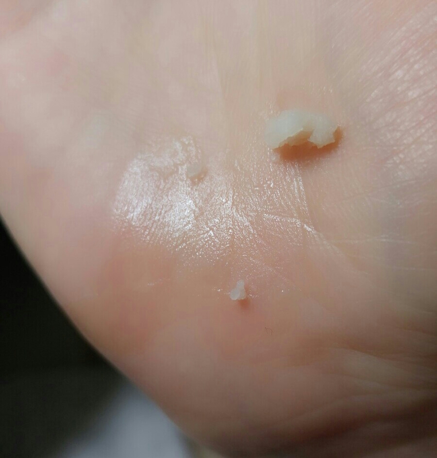 이렇게 손에 덜어서 손가락의 열로 녹여줘요
꾹 대고있으면 체온에 잘녹는답니다☺
