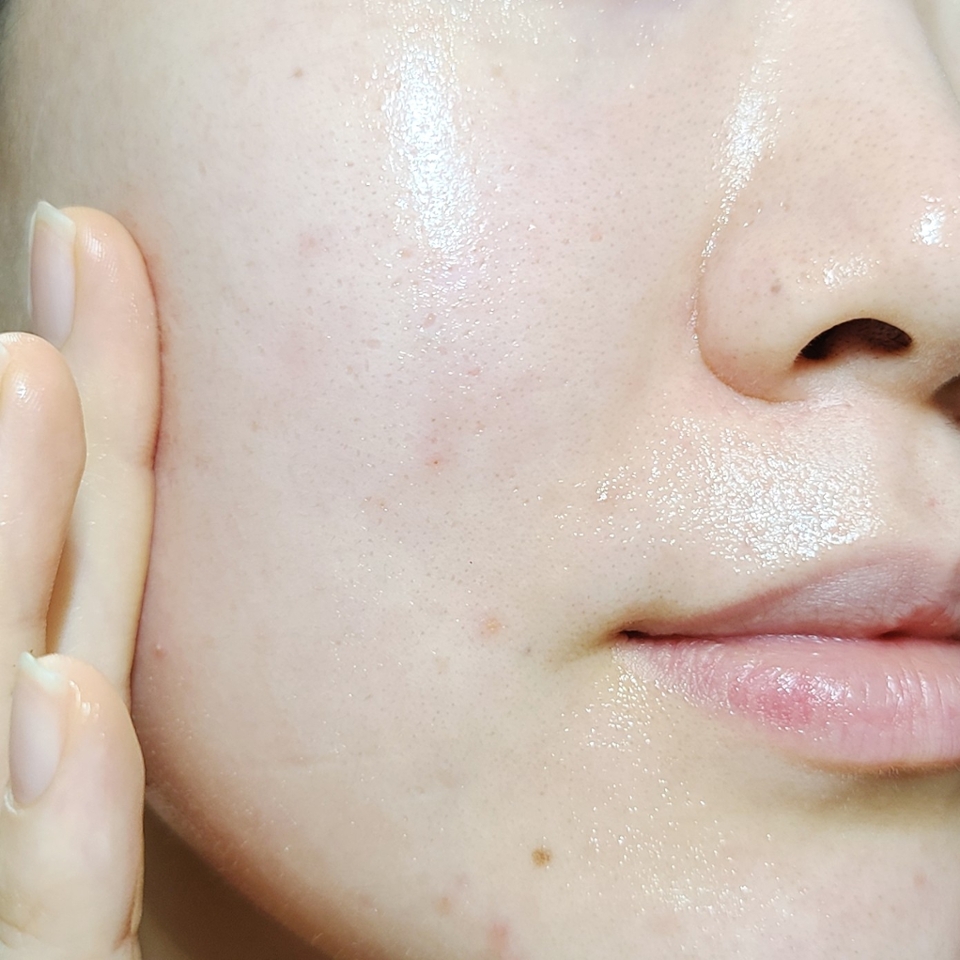 흡수된 후에는 끈적임이나 번들거림 없이 겉은 산뜻! 속은 촉촉💦한 데일리 속탄력 크림 되시겠습니다:D

​

에센스와 크림 모두 4주 사용 후 피부 장벽 개선, 모공 수와 면적 개선, 눈가와 팔자주름 개선에 도움이 되는 안티에이징 효과 확인까지 마쳤다고 해요

​

단순히 사용감만 좋은게 아니라 효과까지 확실하다니 너무 좋은것🧡

