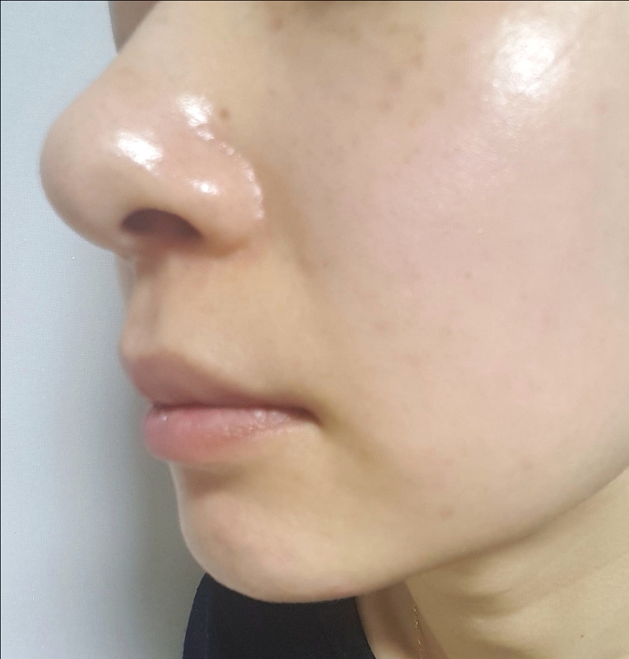 전 기초를 촉촉하게 바르는 편이라 밀릴까 걱정했는데 밀리지않구 잘 발렸어요!
메이크업 후에 덧바르기엔 별로에요ㅜ
톡톡 발라도 스틱에 메이크업이 묻을뿐 더 덧발라지진 않더라구요
밀며 발랐을땐 다 벗겨지구용
기초후에만 사용하는걸 추천드려요!
그리구 생각보다 양이 적은듯해서 바디까지 사용하면 훨씬 더 양이 작을꺼 같아요
메이크업전 선스틱 찾으신다면 추천드려요~