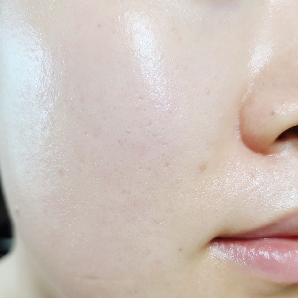 꼼꼼히 닦아내고 남은 에센스는 가볍게 두드려 흡수시켜 주면, 자극 없이 피부결 정돈&수분 공급을 동시에 할 수 있어요
​
거즈면이 피부결을 잘 정돈해 주다 보니 수정 화장 할 때 각질이 뜨거나 화장이 뭉친 부위를 부분적으로 걷어내는 용도로도 활용할 수도 있으니, 요것도 꿀팁!

