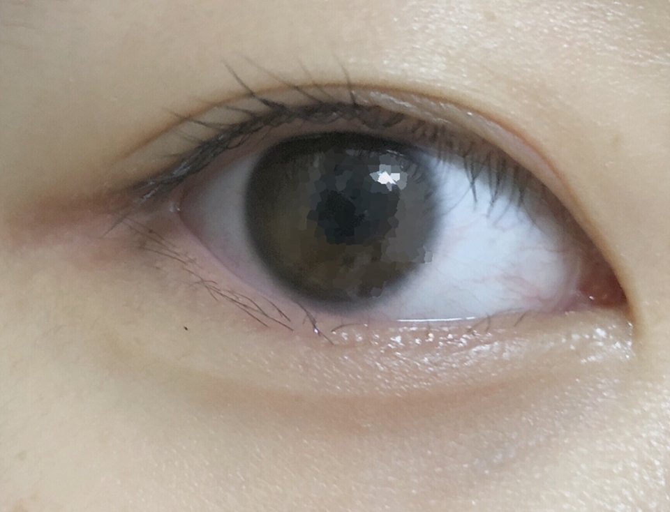 눈에 들어가면 엄청 아프지만 항상 줄어들던 속눈썹이 뒷쪽부분이 엄청많이 길어지고 풍성해졌어요! 마스카라  정도는 다 지워집니다!