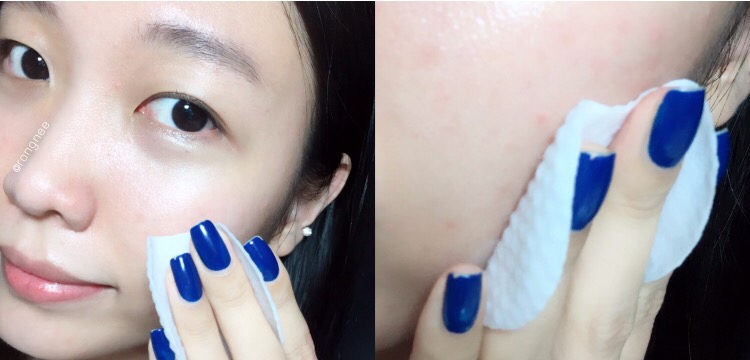 붉은기, 열감, 트러블흉터는 제 피부타입상 어쩔 수
없었지만, 요걸 사용하면서는 확연히 줄어들었어요

붉은기가 많이 사라지고, 바하 성분이 트러블을 소독해주고 각질을 제거해줘서 피부빛이 많이 나아졌어요