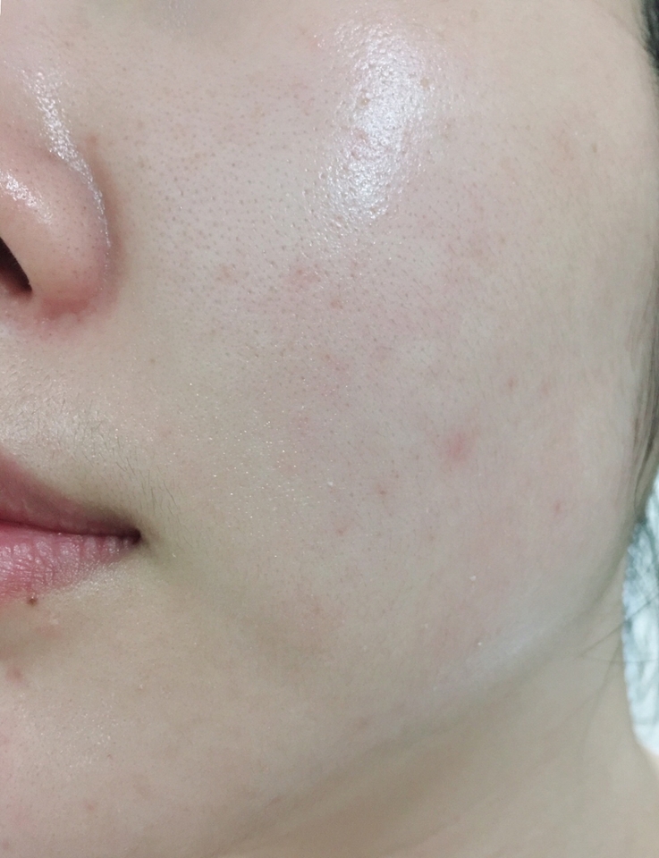 스킨케어를 마친 후 선크림을 얼굴에 골고루 발라봤어요 

흡수되고 나면 선크림 바르기 전, 스킨케어 마친 상태랑 똑같아요
이거 메이크업 전에 사용해도 밀리거나 뭉침현상 하나~도 없어요 
오일free라서 메이크업 후 몇시간이 지나도 유분이 올라오지 않아요 
유분이 올라온다면 스킨케어, 베이스 메이크업 제품으로 인한 유분이지 선크림으로 인한 유분기는 절대 아니에요 
그렇다고 피부가 건조해지냐! 그건 또 아닙니다 
사용감은 점성없는 물토너를 바르는 것처럼 정말 깃털같이 가벼워요ㅜㅜ 
선크림을 바른듯 안바른듯 하지만 자외선 차단 효과는 정말 좋아요 
이런 이유 때문에 제품명이 퓨전워터 가 아닐까 추측해 봅니다 
게다가 앞서 말했듯 Safe eye tech 라서 눈시림이 하나도 없어요 