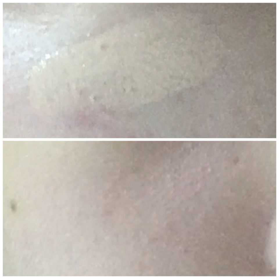 더페이스샵 파운데이션을 이용해서 피부잡티 여드름 흉터등을 커버해줬어요! 
저는 다이소 똥퍼프로 발랐습니다!
그 외에 다크서클이나 점은 아리따움 컨실러로 했어요!