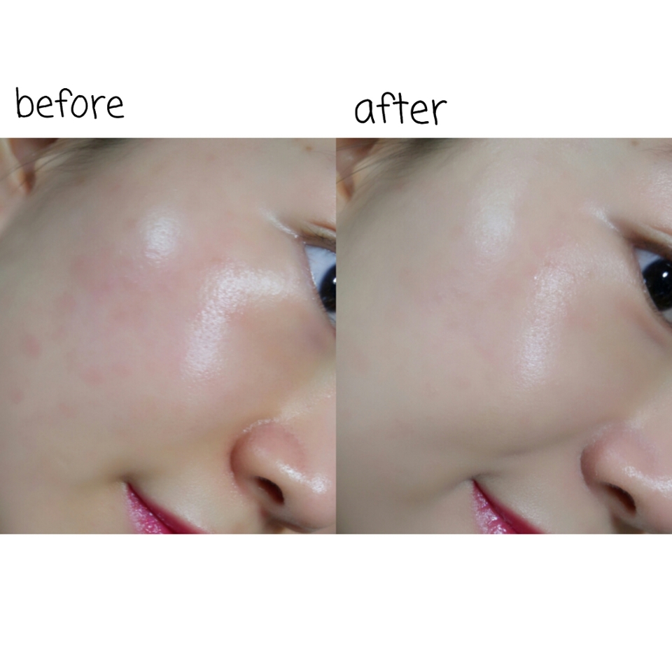 확실히 전후사진에서 커버력 비교가 되네요😂
핑크베이스인데 생각보다 붉은 자국들을 잘 가려주더라구요.
