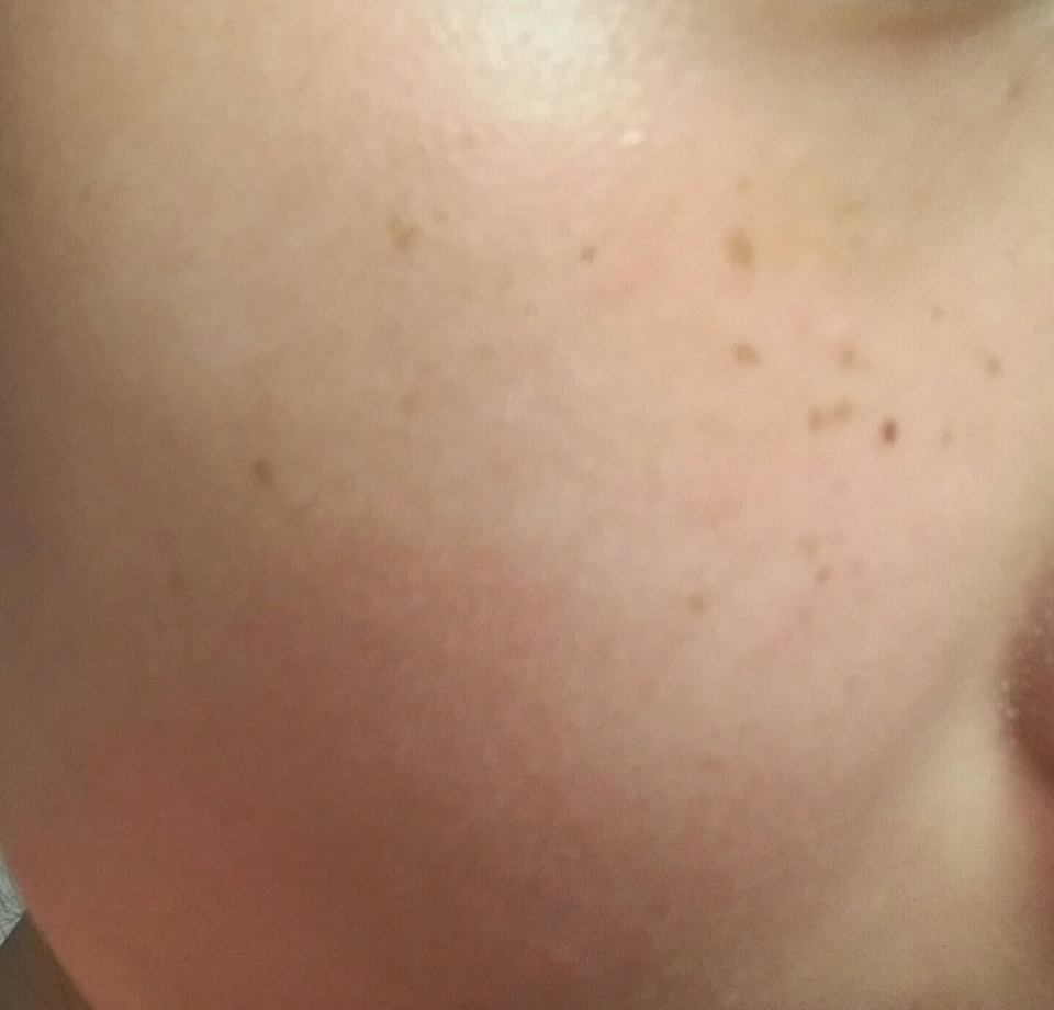 그냥 생 제 얼굴!!주근깨를 커버해줄께요!!