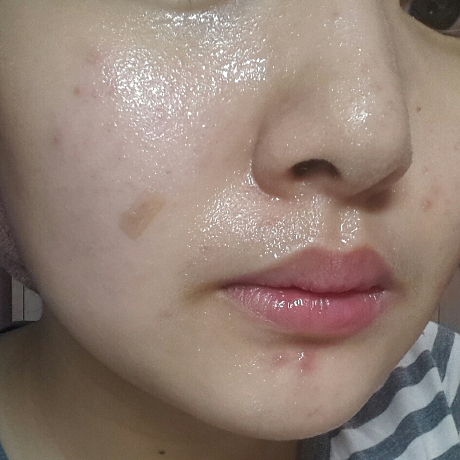 송글송글