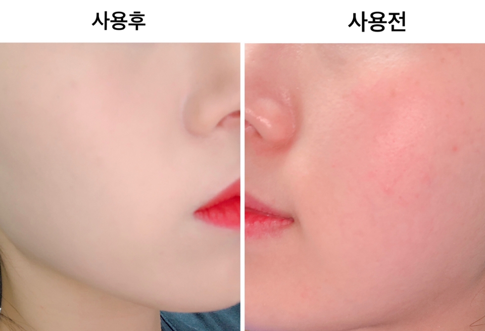 비포 애프터를 쓸 필요도없지만
그래도..적어놨어요^^

겨울엔 피부가 유독 붉어지고 홍조가 생기며
잡티,기미,착색 등등이 난리나는 피부인데요
붉어지면서 동시에 칙칙해지기까지해서
겨울엔 베이스제품에 신경을 많이 써요
지성이라 무너짐,기름까지 커버해야해서
과정이 복잡했는데
다행히 블랙쿠션 17호가 대박 잘맞더라구요^3^

이거 좋은 게 17호는 밝으면서도
너무 밝지는 않고(?) 커버력도 센데다
세미매트라 기름많은 지성피부
 겨울철에 딱 적절해요!
코 옆이나 눈가 주름에도 더럽게 끼이지 않고
무너짐도 딱히 느끼지 못했어요
스킨케어 다음에 프라이머 하나만 깔아줘도
하루종일 튼튼하게 잘 버티는데
화사하기까지 해서 좋아요!!!
인생쿠션입니다 리필까지 들어있고
헤라인데다, 컬러가 찰떡이라 재구매의사 있어요ㅎㅎ
