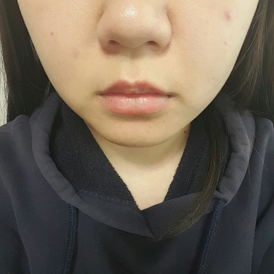 제 맨얼굴입니다!!수분크림까지 바른상태~
오늘을위해 트러블도 나주시고 거뭇거뭇 상태가 말이아니죠😭😭😭
너무 밝은거 산거아니냐고 하실수도있는데 저는 목보다 얼굴이 더 어두워요😂 그리고 베리떼가 다른파데보다 좀 어둡게나왔다고하더라구요! 참고하세요~