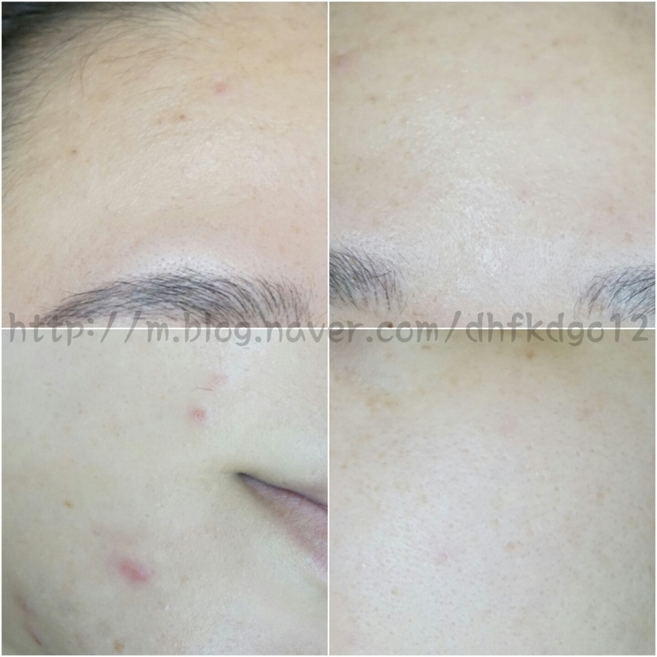 그래도 제일 중요한건 뭐니해도 효과가 어떻냐가 제일 중요하겟죠!

사진은 5월 12일에찍은 사진이에요.
저날 바로 올린다는게 귀찮음으로 지금 올리네요 ㅠㅠ
꾸준히 써서 나중에 변한피부도 올려볼께요! 현제 제 피주는 저상태

궁금한점은 댓글 달아주세요!