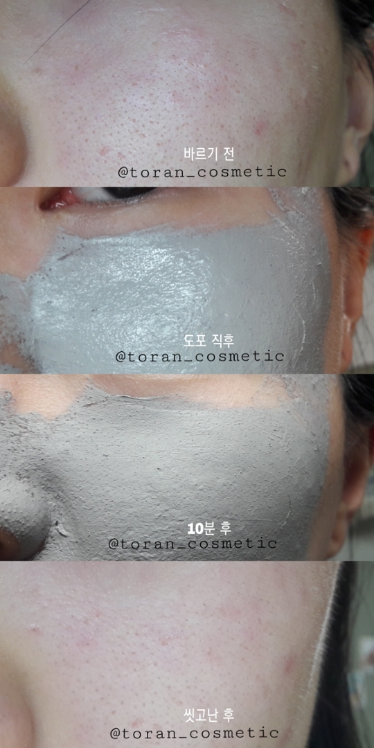사용법은 간단합니다. 얼굴을 씻고난 뒤 마른 얼굴에 도포해줍니다! 그리고 약 10분뒤에 미온수로 씻어내면 돼요. 처음에 발랐을땐 촉촉했는데 10분뒤엔 딱딱하게 굳습니다. 그리고 미온수로 씻어주면 부드럽게 잘 씻겨나가요:) 참 미온수로 씻어낼땐 문질문질하면서 씻어내주셔야합니다. 

전과 후를 보니 외관상 큰 차이는 못느끼겠지만 붉은기가 줄어들었단건 확실히 알 수 있었어요! 마스크에 쿨링기능이 있어 열을 좀 식혀주더라구요:) 그리고 각질들도 미세하게 있던 친구들이 씻고난 후 어느순간 사라져있었습니다. 긴가민가했는데 확실히 토너로 정리하고 나니 걸리는 것 없이 피부가 매끈해졌어요💕

무엇보다 베이스가 너무 잘먹어서 놀랐습니다. 제가 평소엔 열감이랑 각질때문에 베이스가 쉽게 뜨고 토해내는데 이거 쓰고나선 코 옆부분을 제외하곤 안떠서 신기방기했어요.

요런 떠서 발라 씻어내는 타입의 마스크는 잘 안쓰는데 이 친구를 사용해본 뒤로 생각이 바뀌었어요💕 저처럼 안쓰시는 분들도 한번 테스트 해보시면 생각이 바뀌실거라 예상합니다!