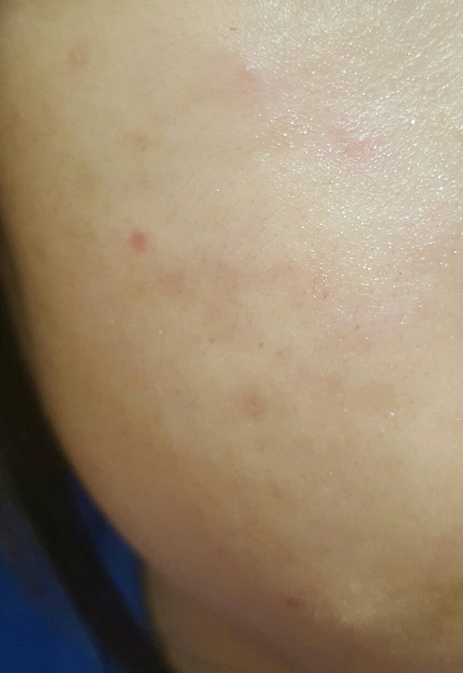 토너 바른 직후!초크초크함이 느껴지시나욤