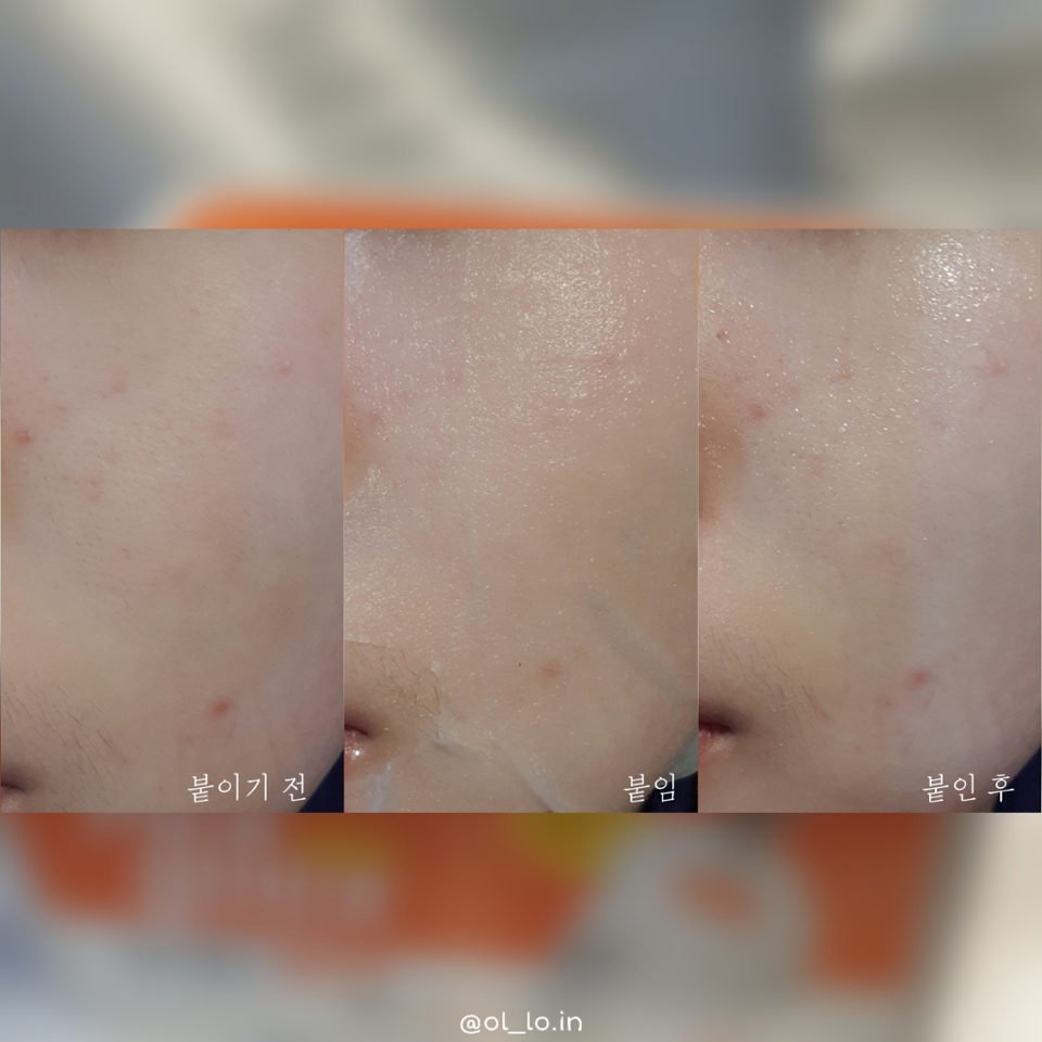 냉장고에 넣어놓지도 않고 상온에 보관하다가 써봤는데 쉬원하게 쿨링 효과가 있었어요🧊❄

마스크팩을 땐 후에 30분 정도? 시간이 지났는데도 얼굴에서 쿨링감이 조금 남아있어서 신기했어요!!

저는 마스크팩의 찐득거림을 싫어하는데 찐득거림도 없고 미끈거리는 것도 없고 가볍고 빠르게 흡수되더라고용⁽(◍˃̵͈̑ᴗ˂̵͈̑)

수분, 진정이 된다고 하는데 수분을 가득 채워주기는 부족해서 건성분들이라면 마스크팩 후 다른 제품으로 수분을 채워주셔야해요

붓기 완화 효과가 좀 있더라고요(୨୧ ❛ᴗ❛)✧
아침에 급하게 붓기 뺄 때 유용하게 사용 할 것 같아용