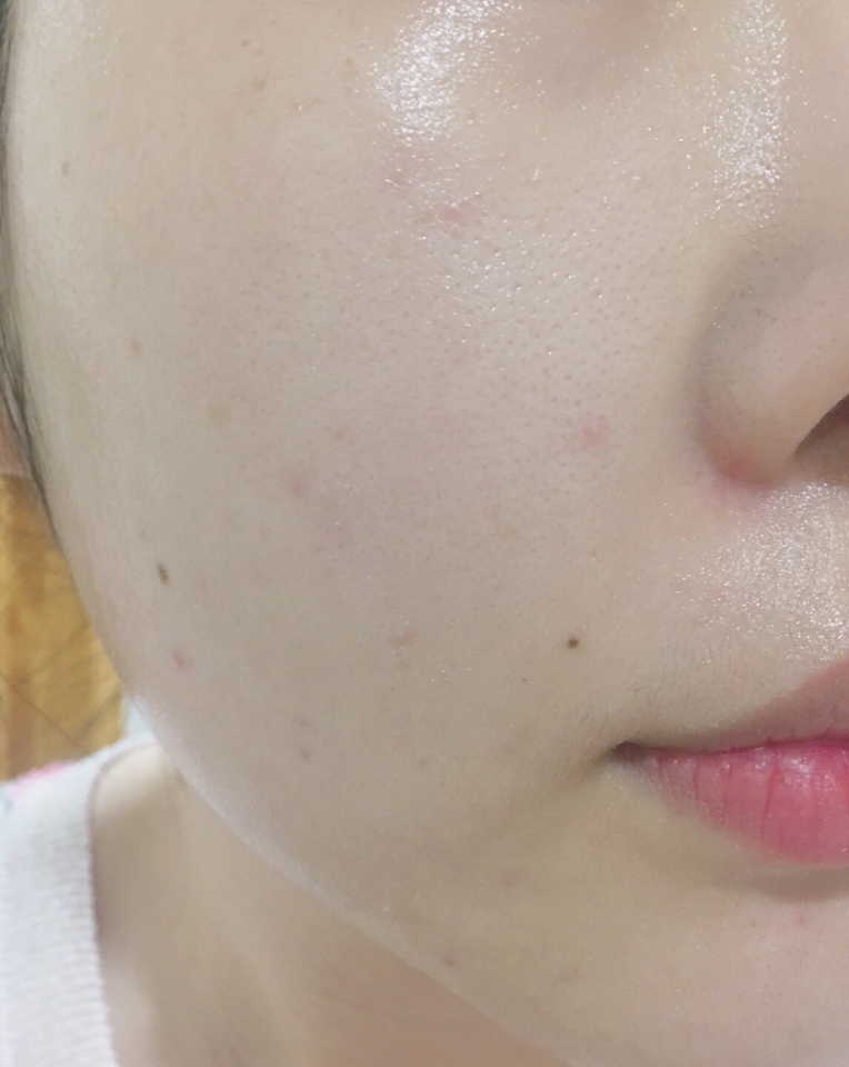 곧바로 크림 발라봤어요 
적당히 윤광이 돌면서 촉촉하게 마무리 돼요 
화이트 히비스커스, 센텔라 아시아티카, 놋위드의 3가지 꽃 추출물이 들어가 있고 진귀한 화이트 꽃의 향이 은은하게 난다고 설명서에 적혀있던데 그래서 그런지 향이 너무 향기로워요 
매일 사용해 봤는데 제 피부타입에는 (중성) 딱 좋았어요 
하지만 건성분들이 추운 겨울에 사용한다면 보습 면에서 살짝 부족하다고 느끼실것 같아요 
자기 전에 이거 바르고 다음날 메이크업 하면 화장도 잘 받고 제 피부에는 보습도, 수분 충전으로도 좋아서 만족해요 
