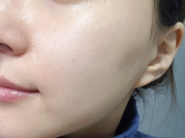 :: #클렌징 순서 6단계 :: 

웬즈데이 시카수분크림으로 마무리
 

미세먼지에 취약한 민감성피부수분크림으로도 좋은

 웬즈데이시카수분크림 
수분가득한 수분폭탄크림이라 산뜻하게 클렌징을 마무리해줘요

