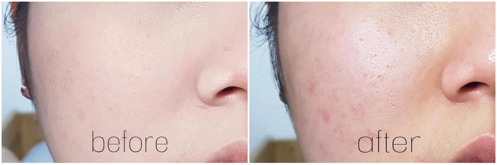 선크림, 미세먼지, 모공 속 노폐물까지 말끔한 세정이 가능하다고 해요!
실제로 자외선 차단 제품 세정력, 미세먼지 모사체 세정력, 모공 속 노폐물 세정 효과에 대한 인체적용 시험 결과, 자외선 차단제 95%세정, 모공속 노폐물 99%세정, 미세먼지 모사체 95%세정의 효과가 있었다고 해요😊