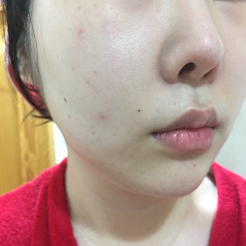 세안 후 스킨케어~프라이머 까지 얼굴에 발라놓은 상태입니다 
보정 하나도 안한 현실 피부입니다😅