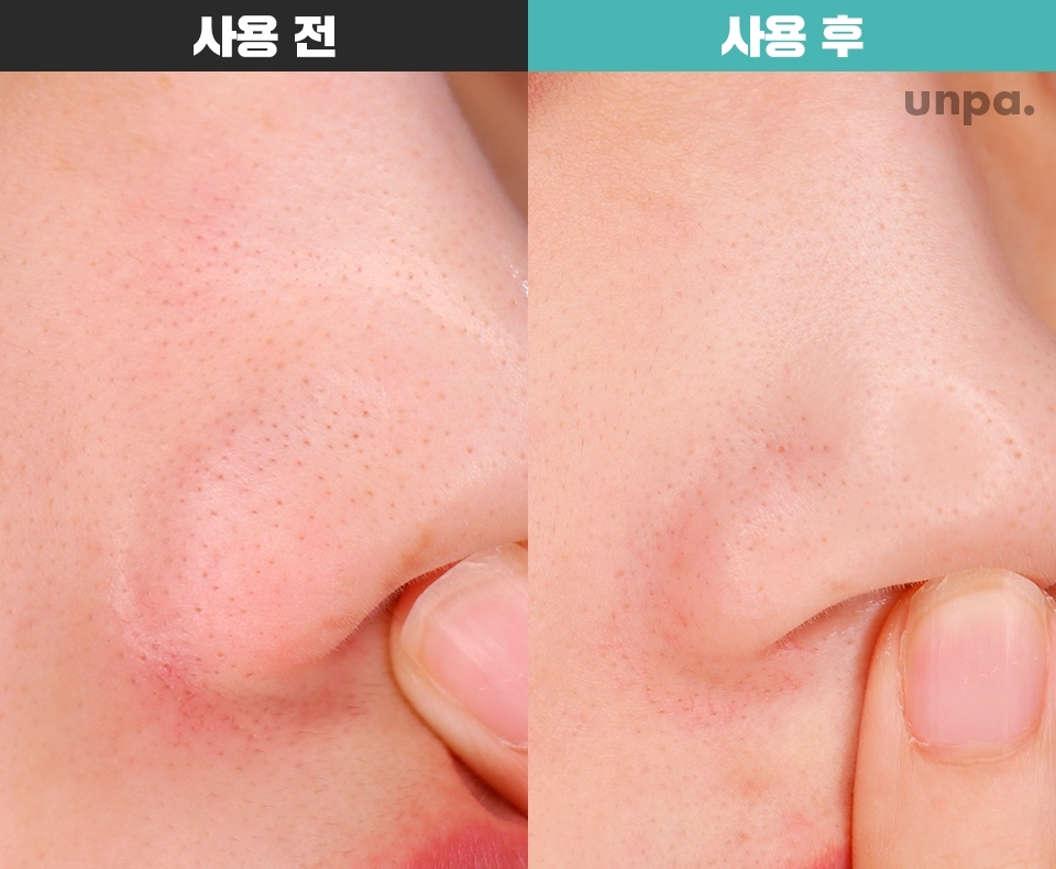 눈으로 보기엔 별 차이가 없는 것처럼
보이겠지만!!!

메이크업 후 코 주변 끼임이
확연히 줄어들었어

피부 표면을 매끄럽게 해주는 효과는 좋은듯해