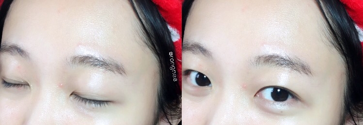 일주일 간 사용하면서 좁쌀은 다 들어가고! 이제 몇몇
트러블 흉터나 코주변 트러블들만 남았어요!

그리고 이제 기초제품 리뷰를 할 수 있게 돼서, 제 기초케어라인에 요걸 포함하길 잘 했다고 스스로 칭찬하면서 자축하고 있답니다 ㅠㅠ
